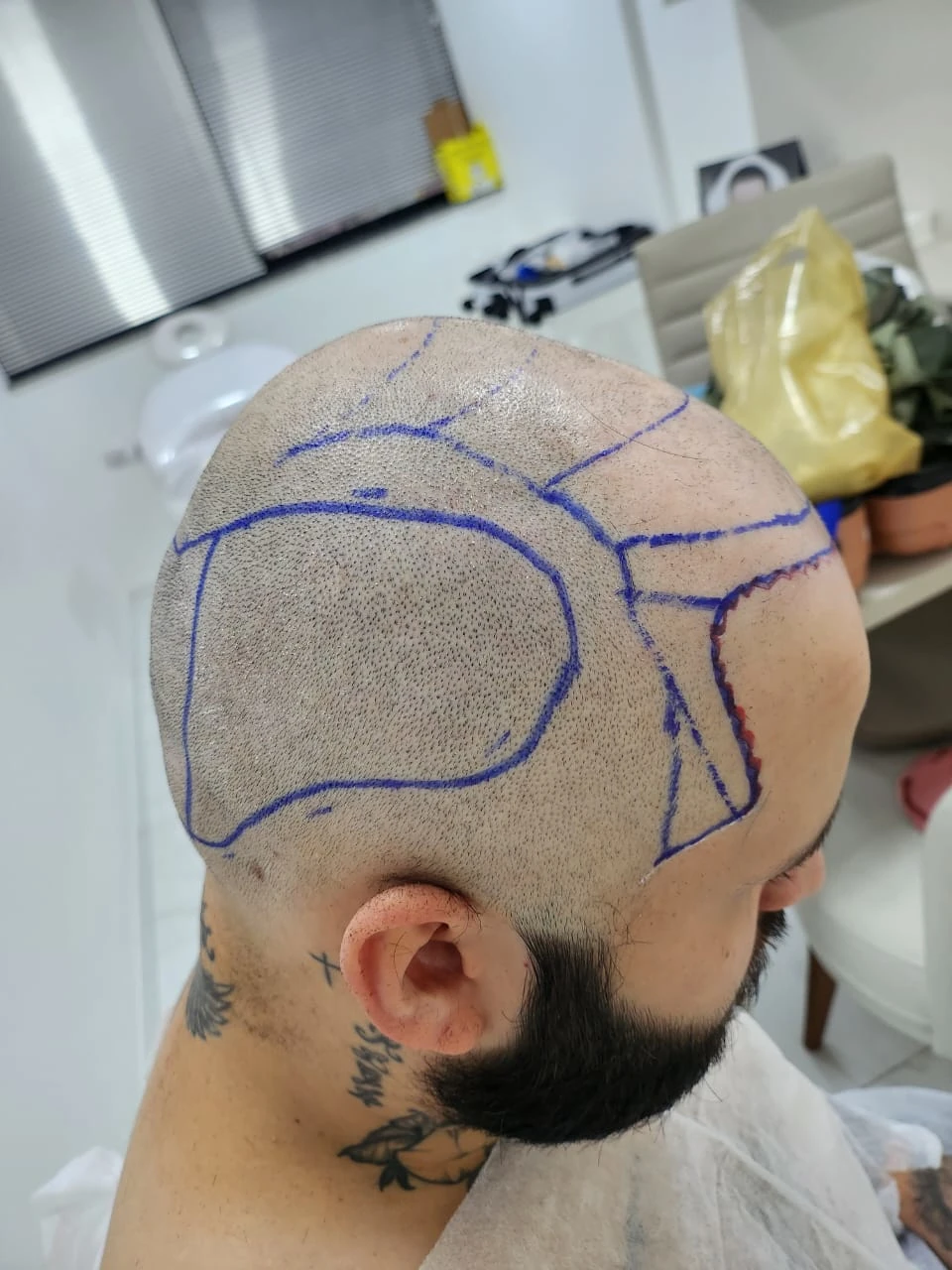 Imagem JPG, Indisponivel